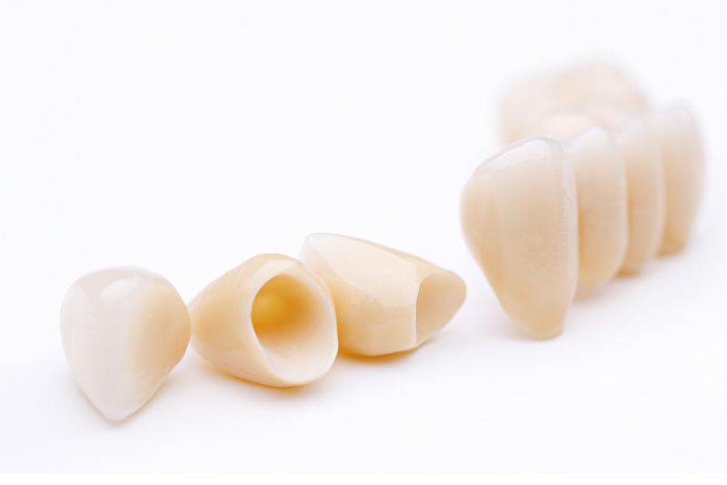 オールセラミック