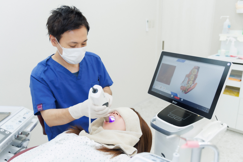 口腔内スキャナー