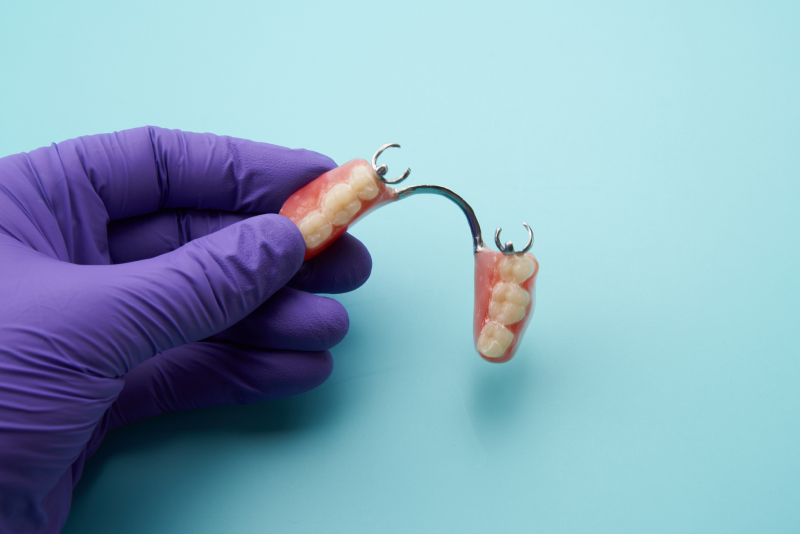 部分入れ歯―失った歯が1〜数本の場合に使用