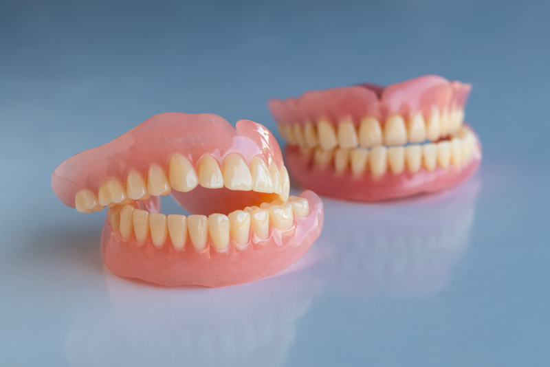 ノンクラスプ義歯